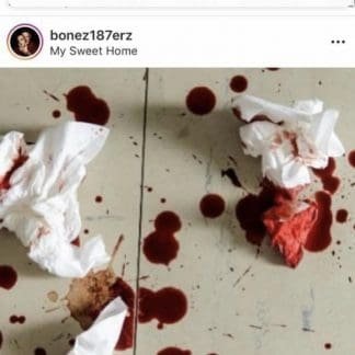 Liebe Hype Awards: Bonez‘ Witze über häusliche Gewalt verdienen keinen Preis